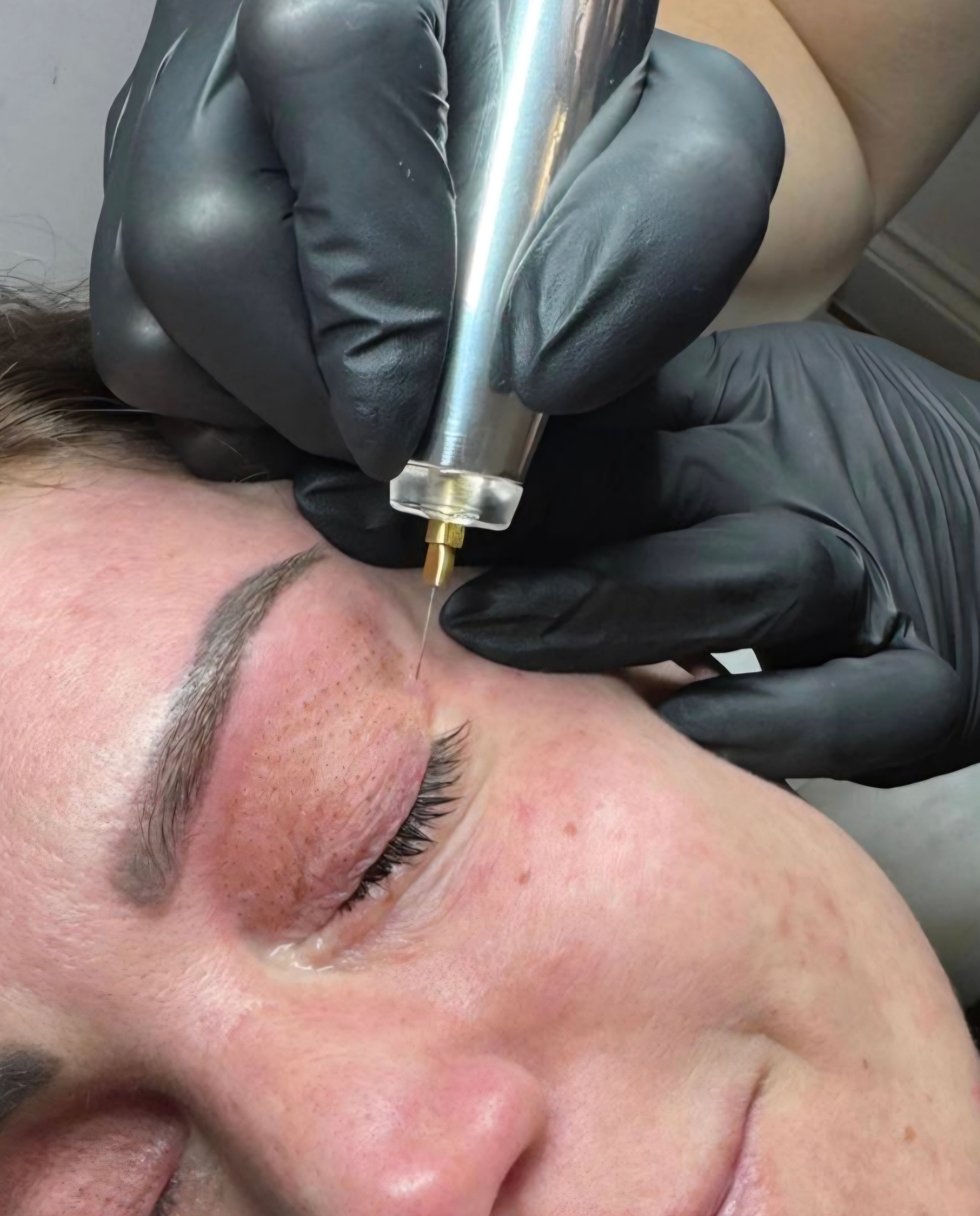 Aesthetic treatment result