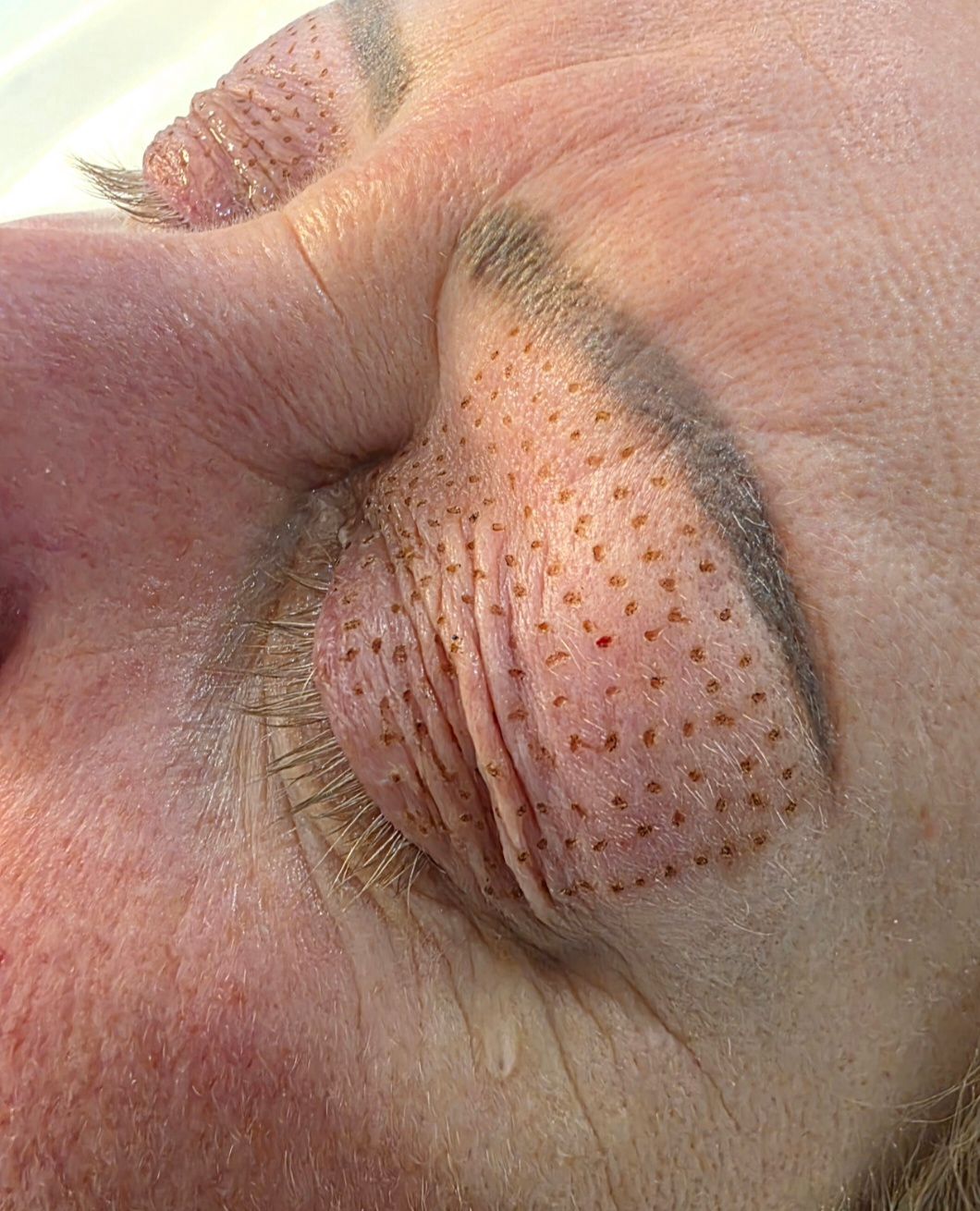 Beauty treatment result