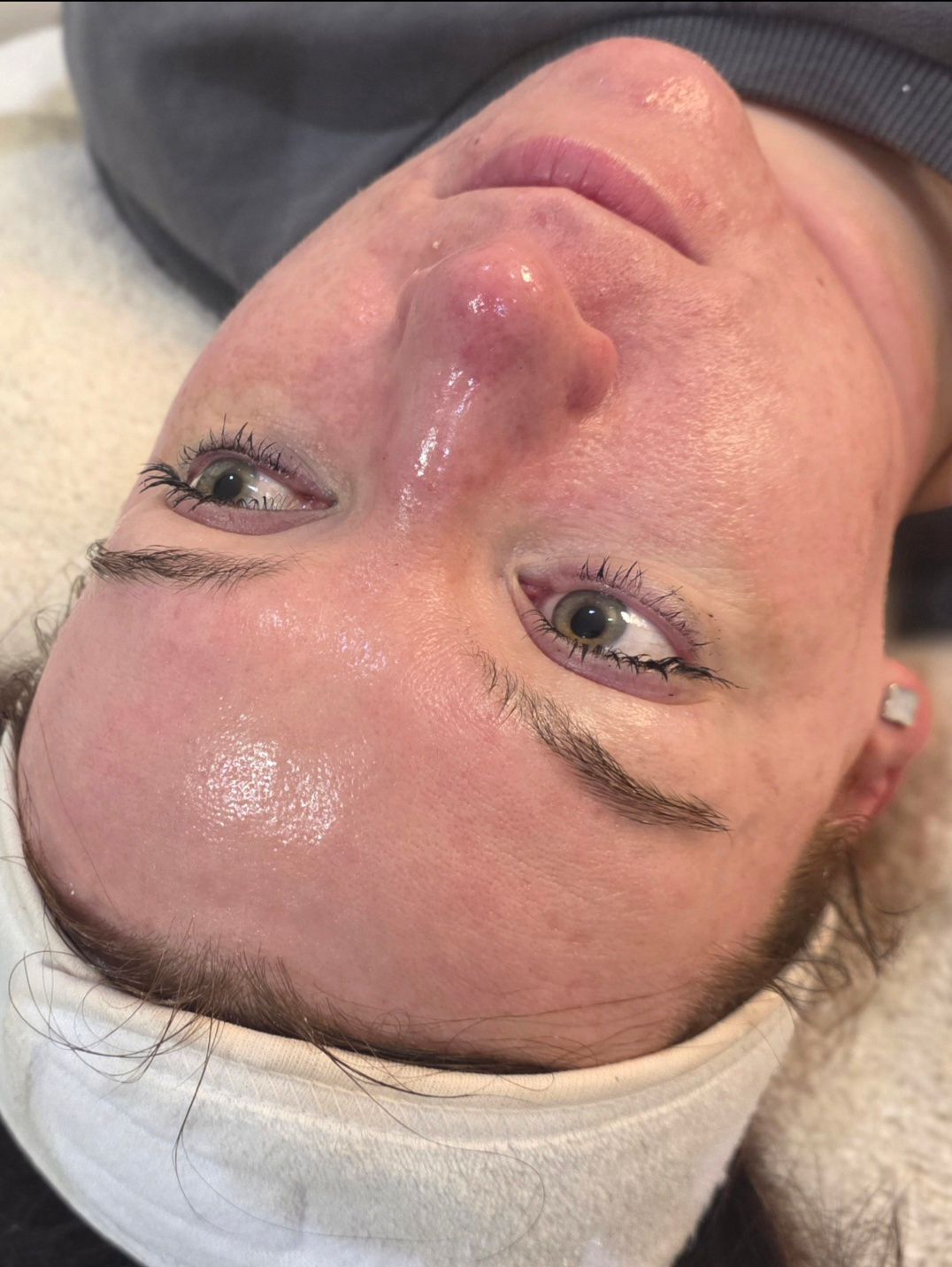 Glow treatment result